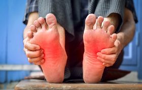 Do You Have Hypothyroidism From Your Burning Feet?