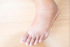 Foot Supination: Diagnosis, Causes, and Treatment