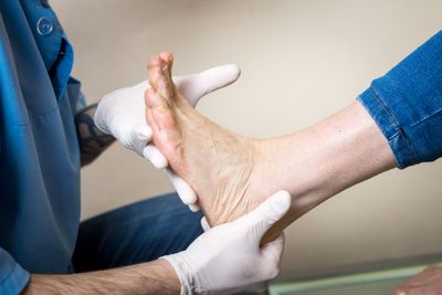 Orthopedist conducts diagnostics, foot foot test of a woman