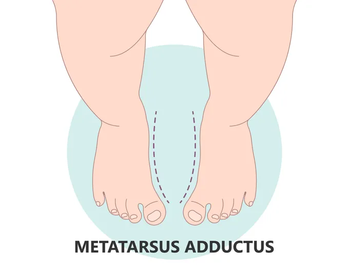 a diagram of a person's feet with a weight scale in front of them