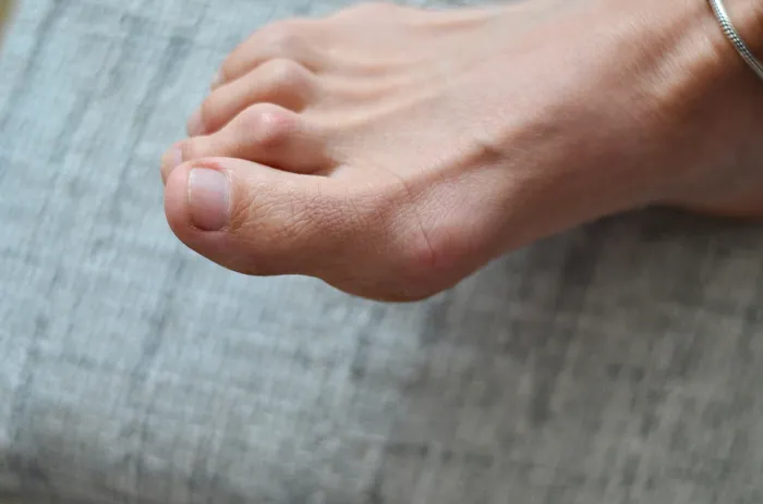 Hammer Toe Exercises That You Can Easily Do At Home 