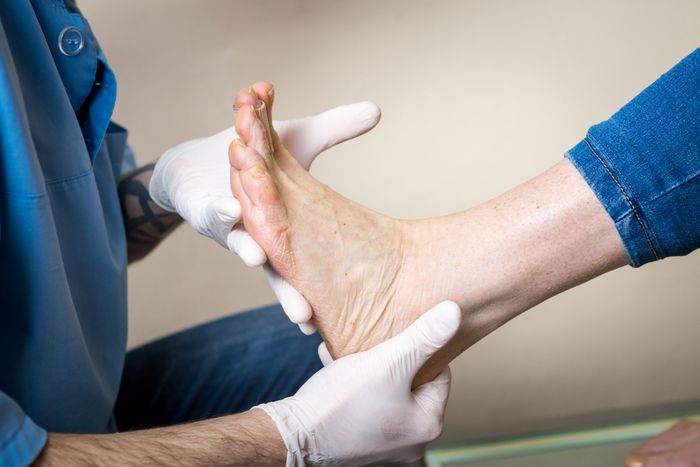 Orthopedist conducts diagnostics, foot foot test of a woman