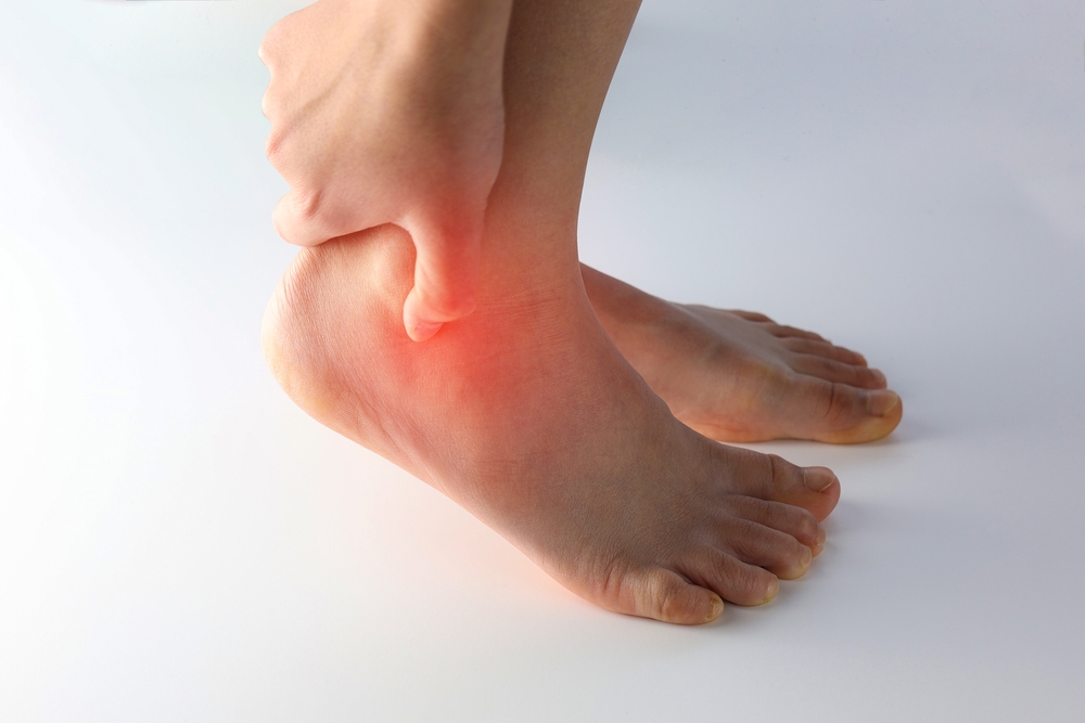 What Is Ankle Arthritis? - MyAnkle